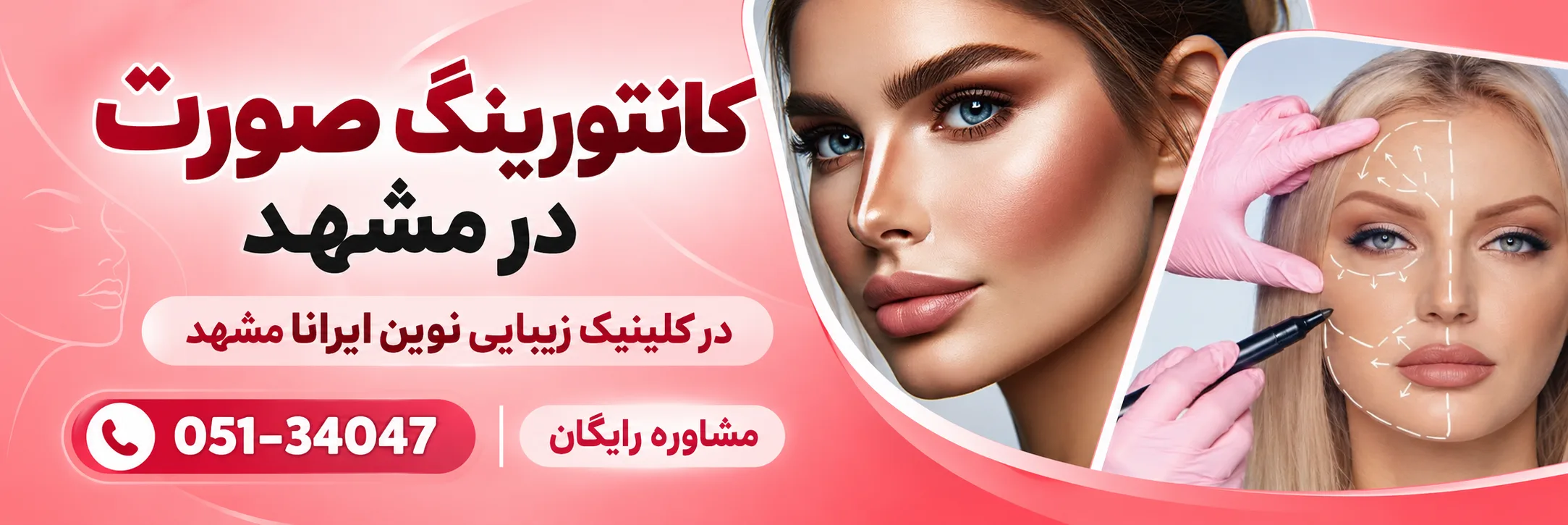 کانتورینگ صورت در کلینیک نوین ایرانا